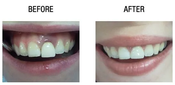 cosmetic dentistry