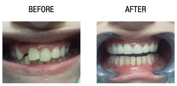 cosmetic dentistry in Gurgaon