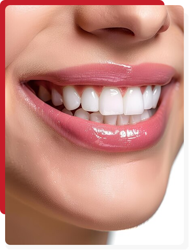 Dental Hygiene in Gurgaon