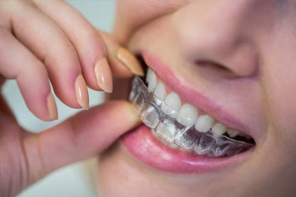 Invisalign Brace Treatment