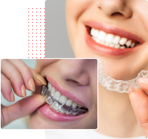 Invisalign Braces Treatment