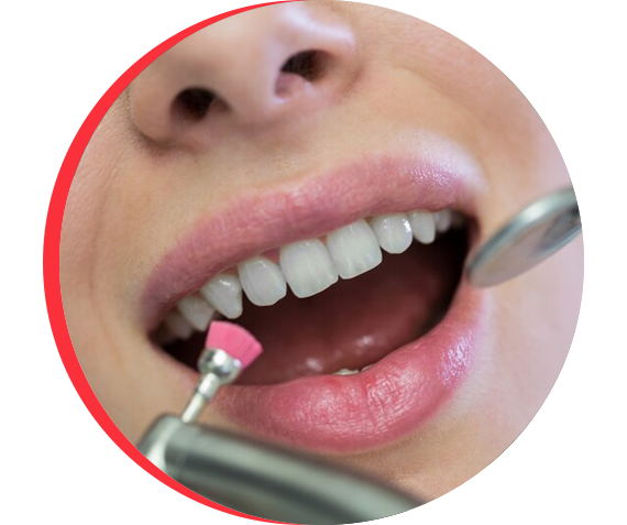 Effective Periodontal Treatment in Gurgaon