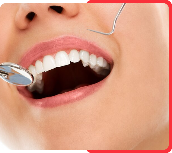 Periodontal Care in Gurgaon