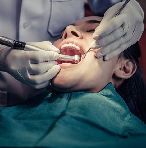 Root Canal Treatment in Gurgaon