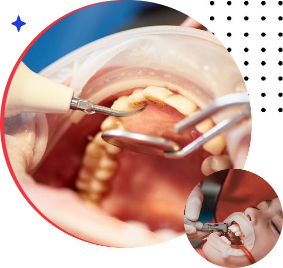 Tooth Extractions in Sector 86