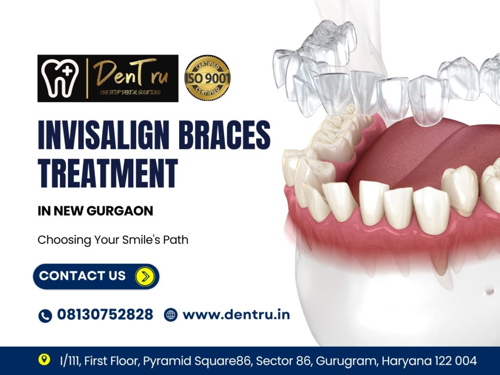 Straighten Your Teeth with Dentru’s Invisalign