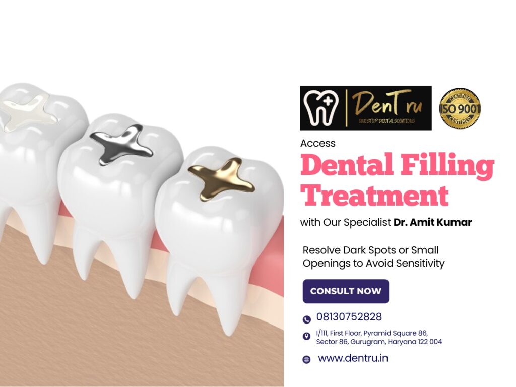 Discover the Advantages of Dental Fillings at Dentru