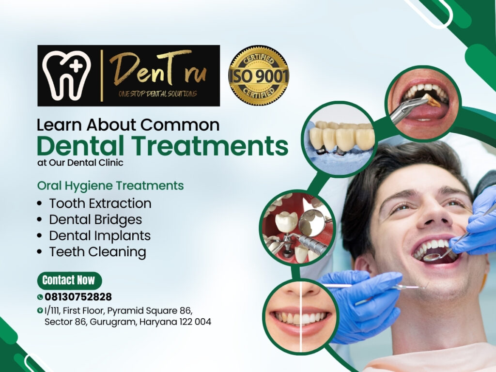 Exploring Dental Treatments in Gurgaon