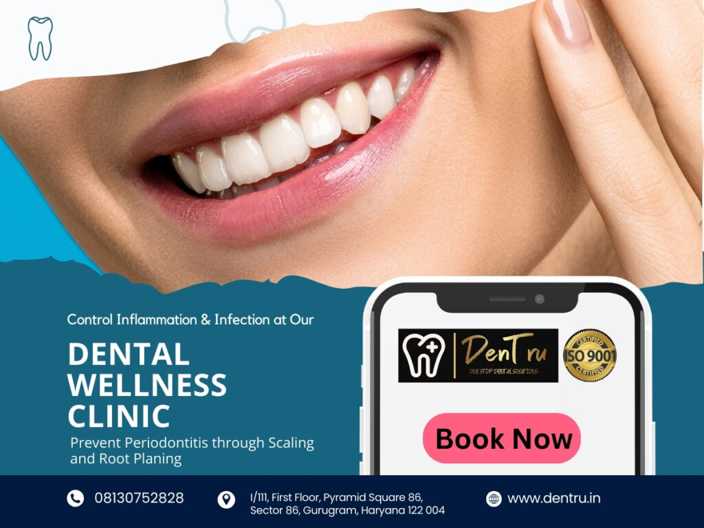 Effective Dry Mouth Treatment at Dentru in Gurgaon