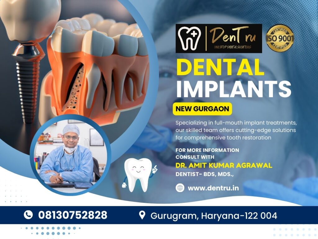 Advanced Dental Implant Techniques in Gurgaon