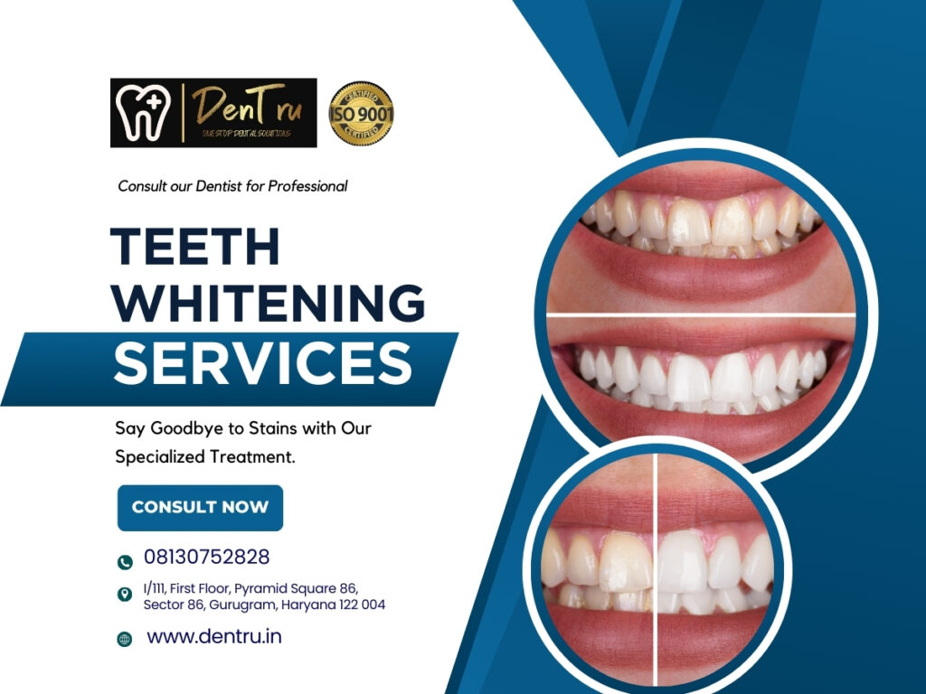 Get Bright Smile with Best Teeth Whitening Solutions