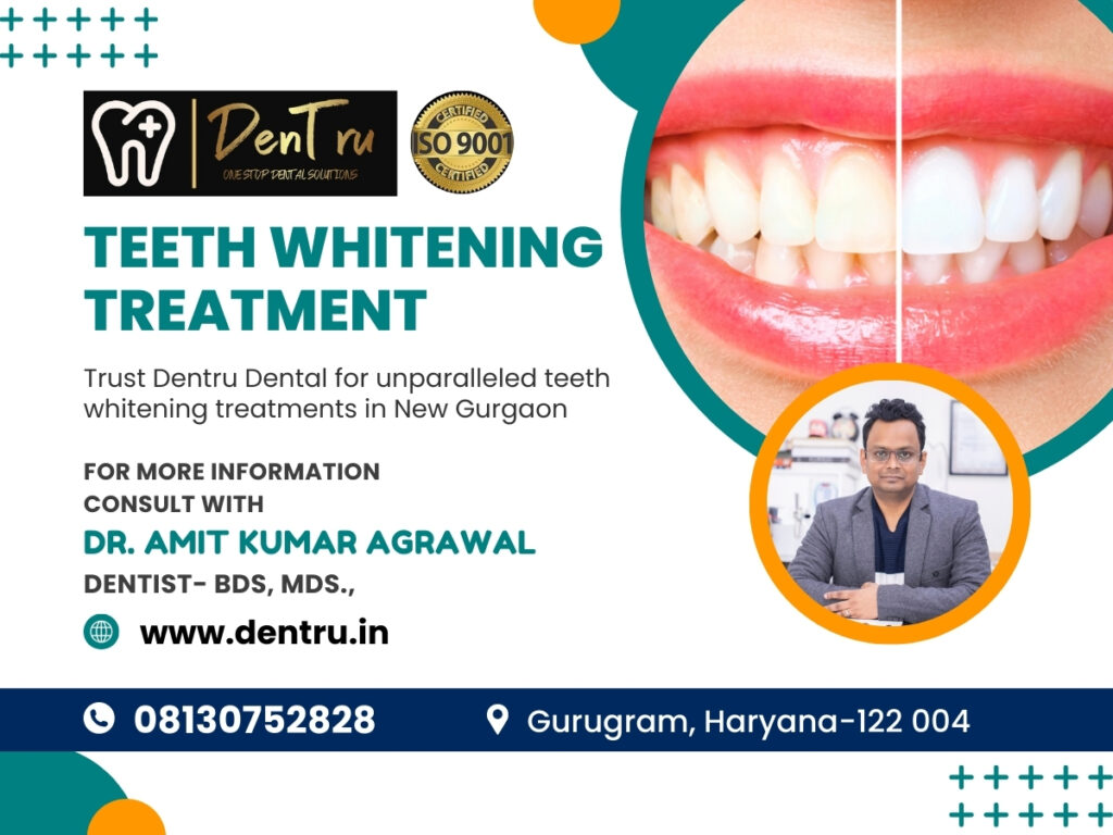 Smile Brighter – Teeth Whitening Treatment at Dentru