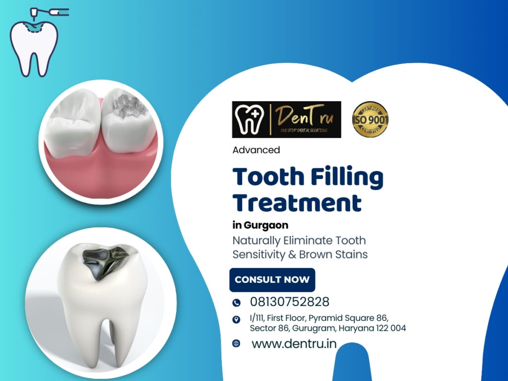 Different Types of Dental Fillings at Dentru